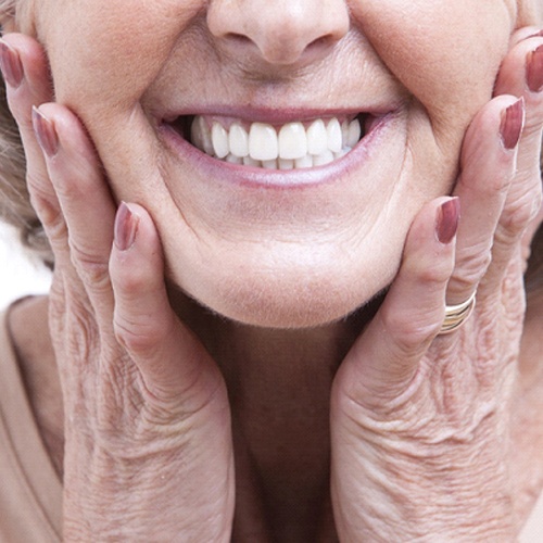 Closeup of patient with All-On-4 dental implants in Jacksonville