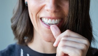 Woman putting on an Invisalign tray