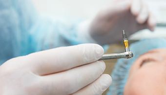 An up-close view of a dental implant preparing to be placed in patient’s mouth in Jacksonville