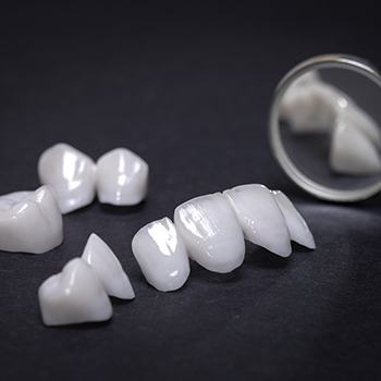 Metal free dental restorations for cosmetic dentistry