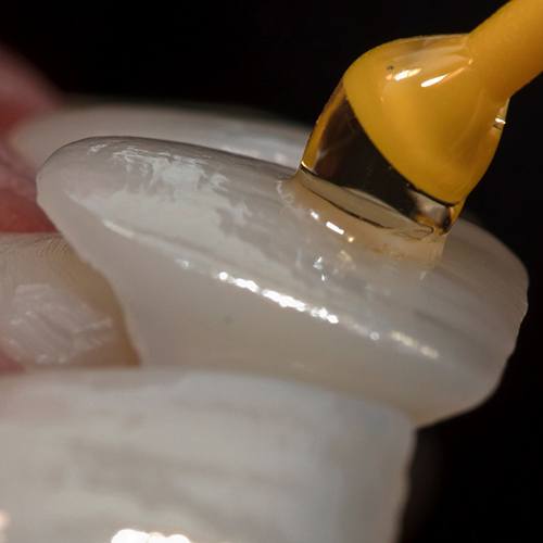 dentist putting veneer on teeth