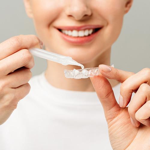 Woman in white shirt applying whitening gel to custom-fitted tray