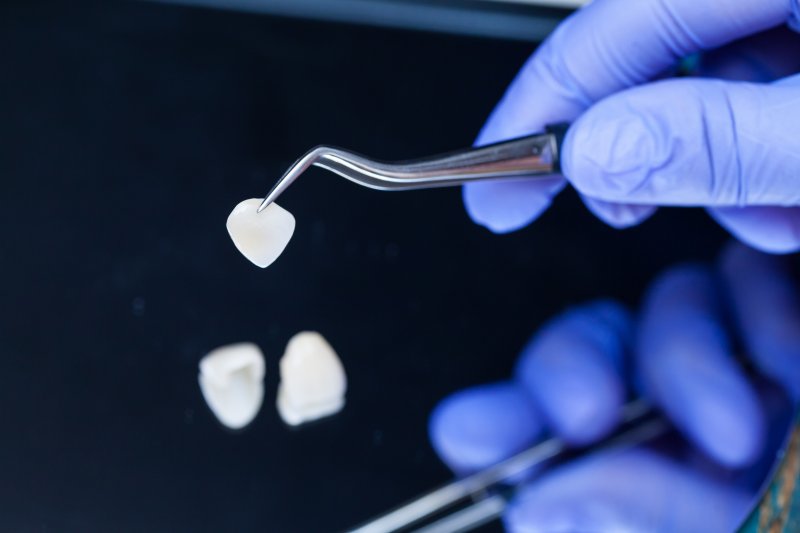 a dentist’s gloved hand holding veneers 