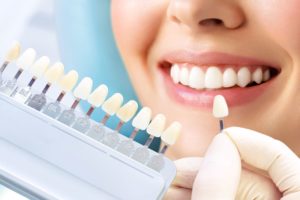 Closeup of a smiling mouth with a dentist holding up different shades of veneers