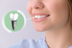 Woman smiling with illustration showing dental implant